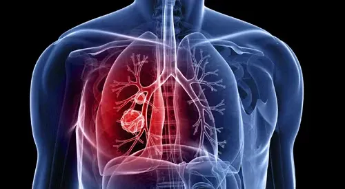 Big Pharma’s $6 Billion Drug Has a Fatal Flaw. This Under the Radar Biotech May Have the Fix (NASDAQ: NVCT)